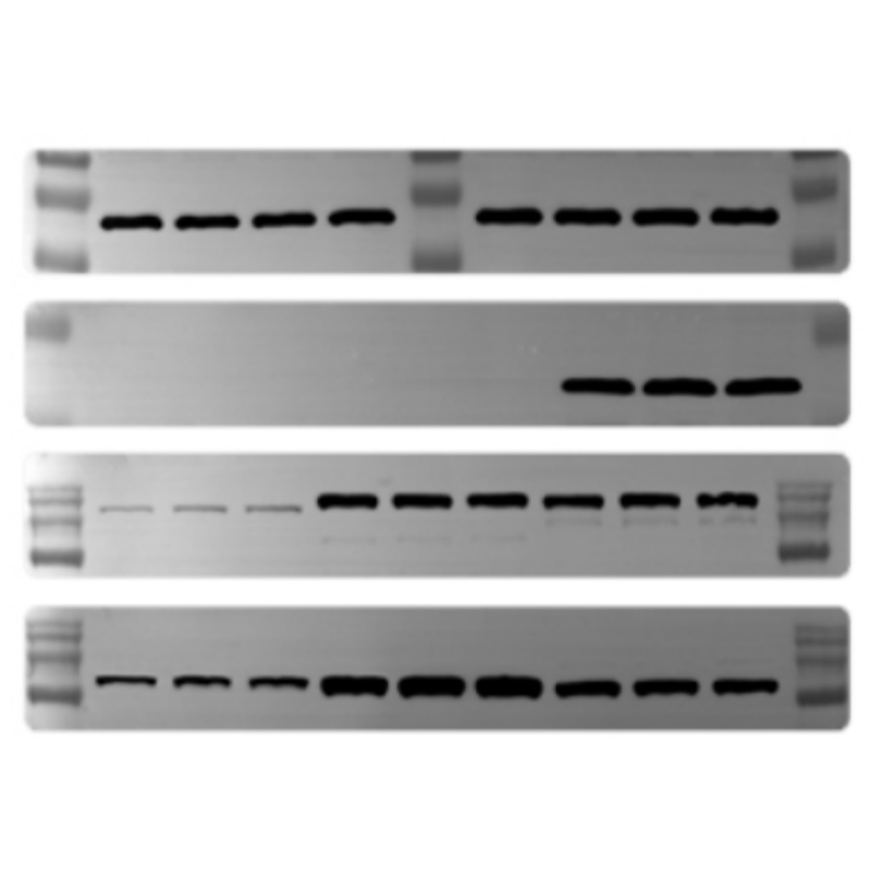 Unveiling the Invisible: A Guide to Chemiluminescence Imaging Systems