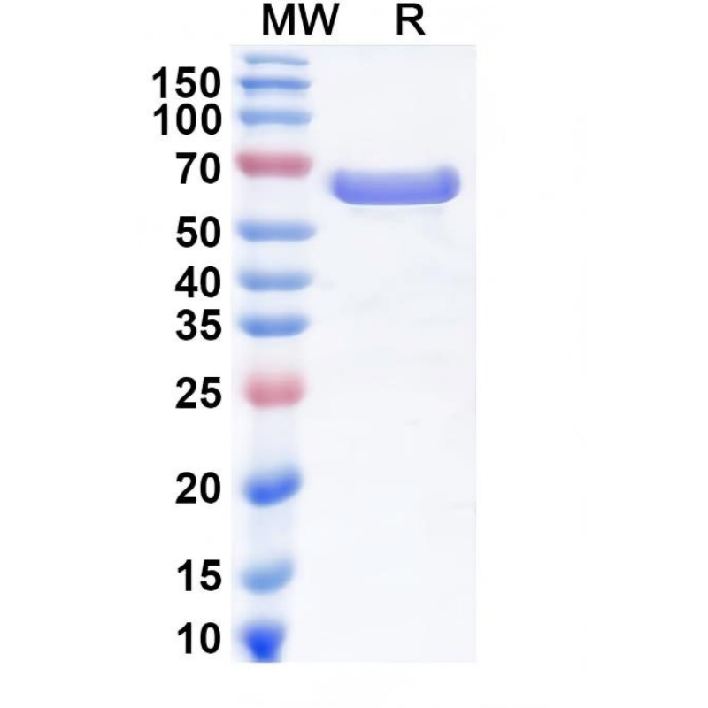 Recombinant Human IL6 Protein C-His