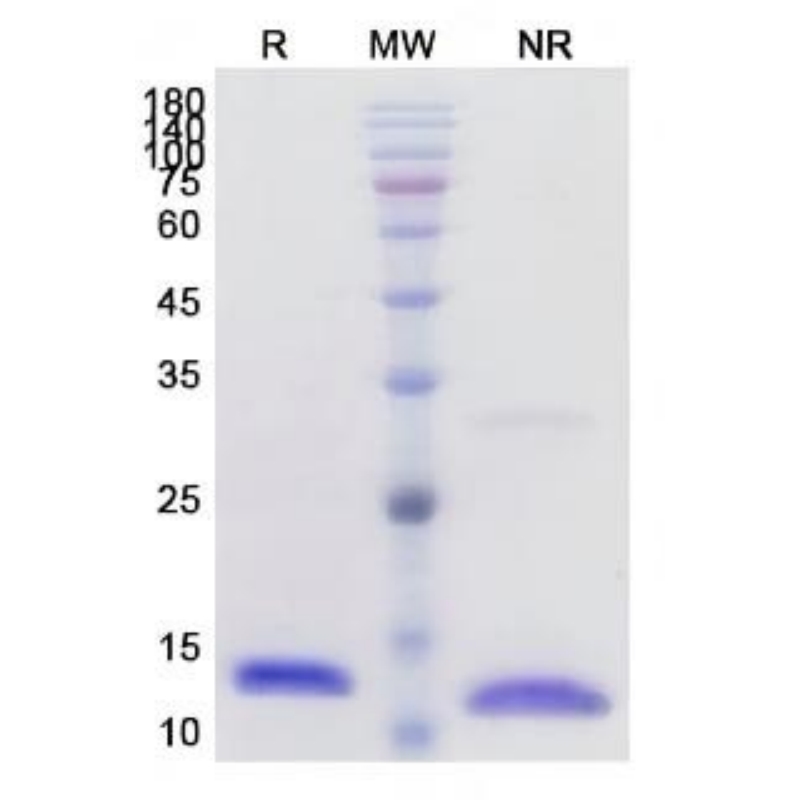 Recombinant Human IL2 Protein
