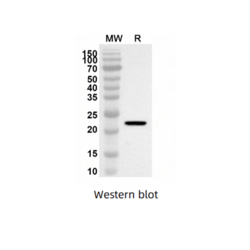 Anti-RUNX2 Polyclonal Antibody